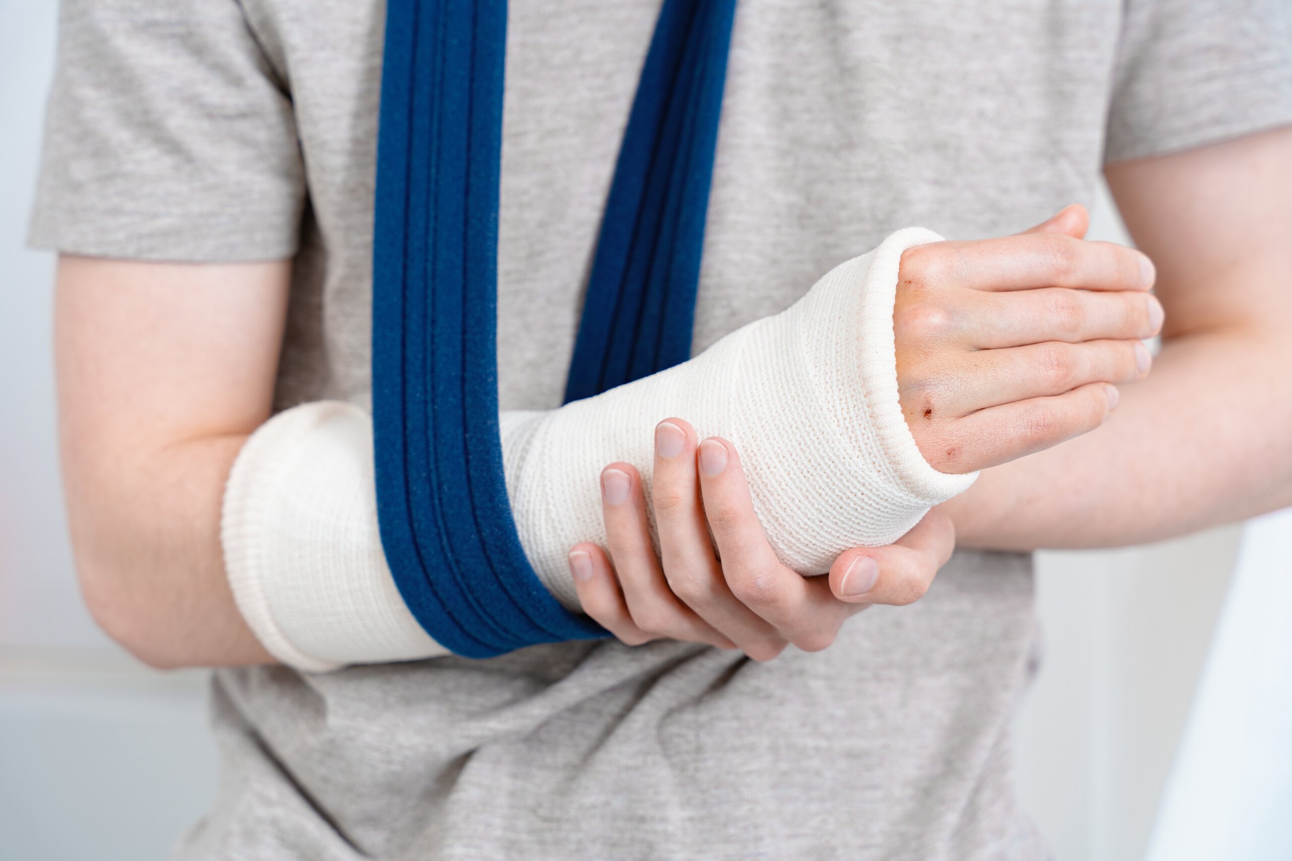 Person with a broken arm in a cast and sling representing injury claim case handled by a Scranton personal injury lawyer in Pennsylvania.