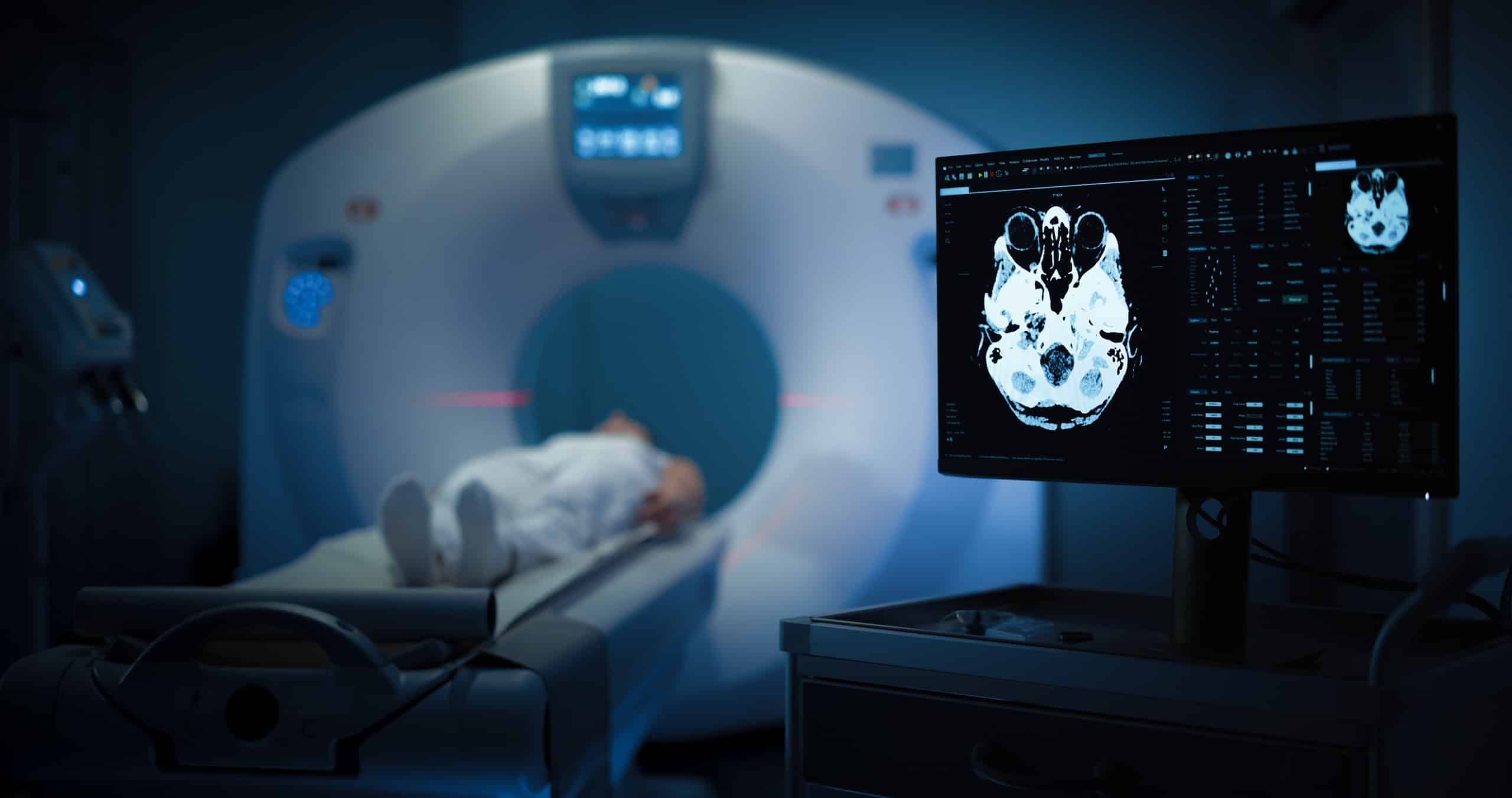 A computer monitor displaying a detailed medical brain scan with a blurred patient undergoing a diagnostic scan in the background, illustrating evidence used by Scranton Brain Injury Lawyers.