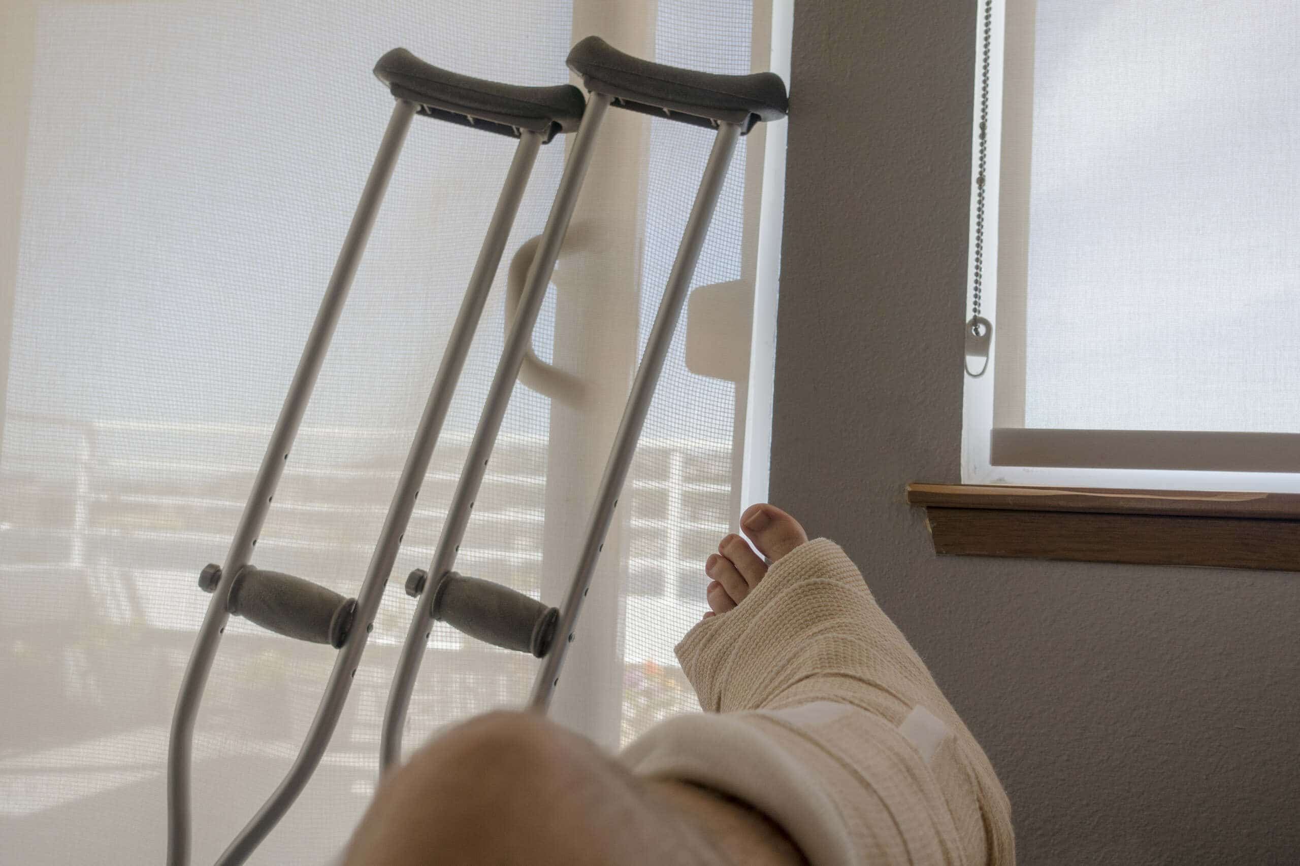 A patient's point-of-view showing a foot wrapped in a thick medical cast next to a pair of crutches resting against a window, illustrating premises liability injuries represented by Scranton slip and fall lawyers.