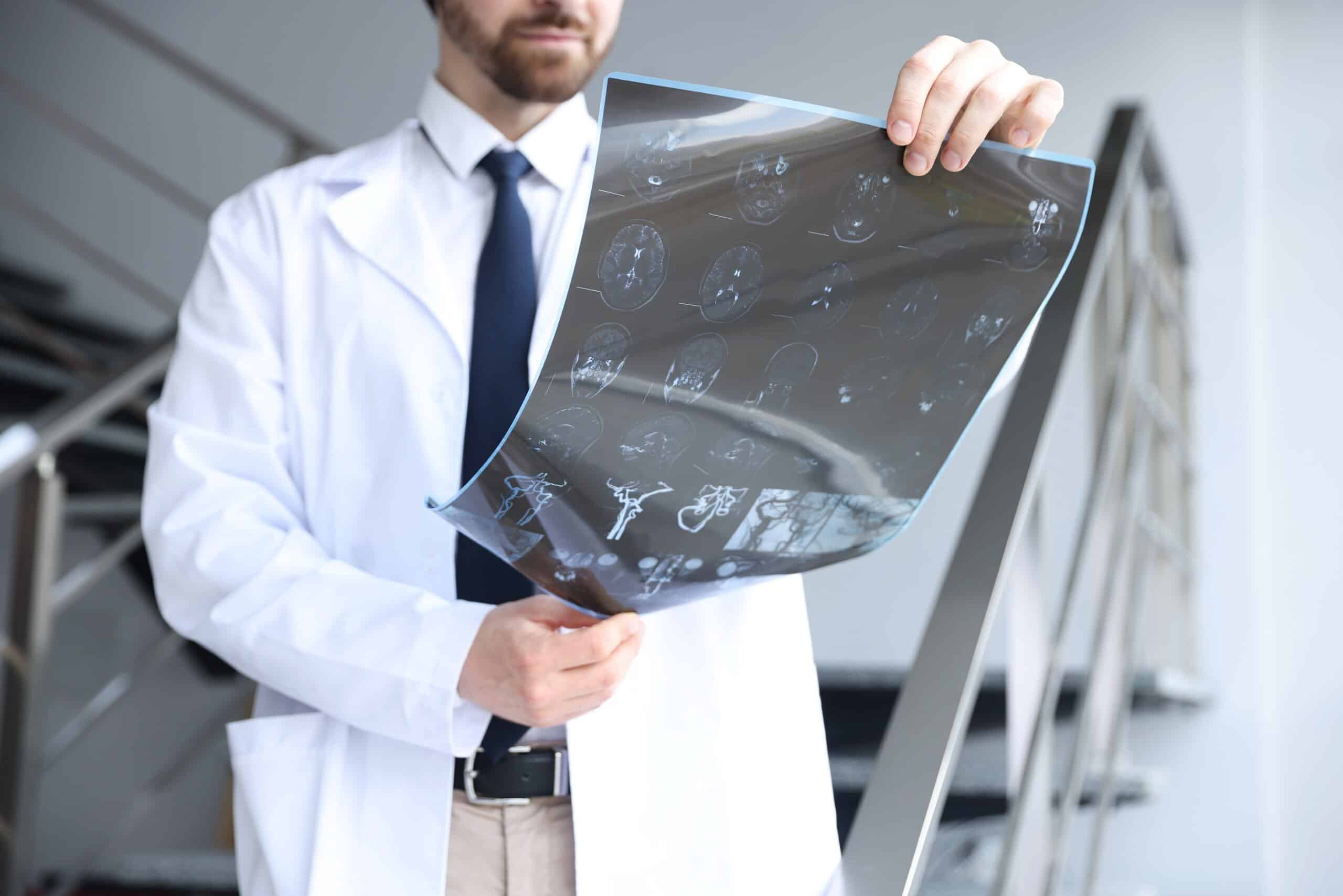 A medical professional in a white lab coat holds up a large sheet of diagnostic X-rays and MRI scans, illustrating medical evidence used by Scranton Spinal Cord Injury Lawyers.